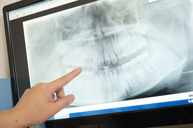 丁寧でわかりやすい説明